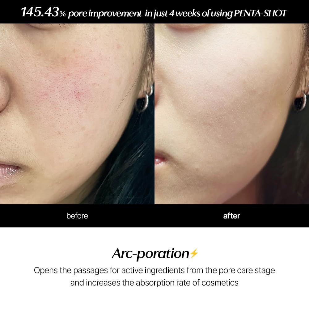 "145.43% pore improvement in 4 weeks with PENTA-SHOT. Before: visible pores. After: smoother skin."